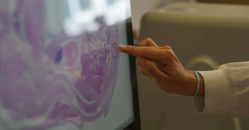 "Não temos uma Europa à mesma velocidade". Projeto quer travar desigualdades no combate ao cancro