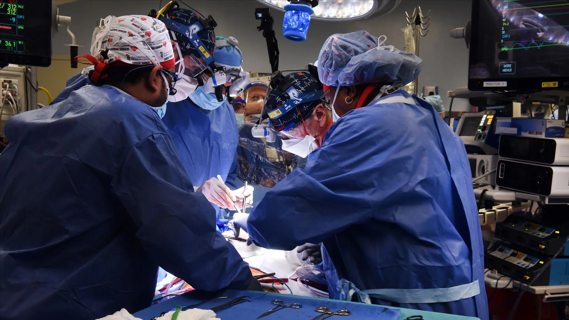 Portugal com máximos históricos de transplantes cardíacos e pulmonares em 2025