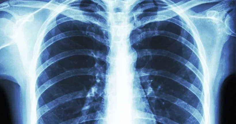 Universidade de Coimbra desenvolve compostos inovadores para tratamento do cancro do pulmão