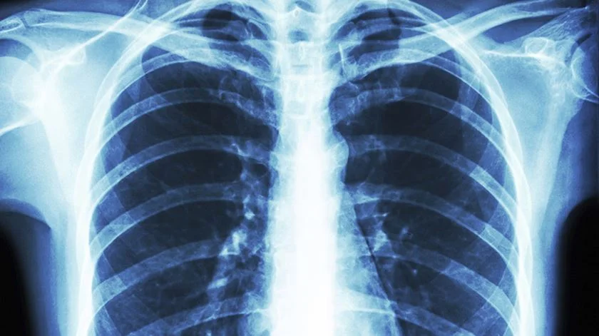 Universidade de Coimbra desenvolve compostos inovadores para tratamento do cancro do pulmão